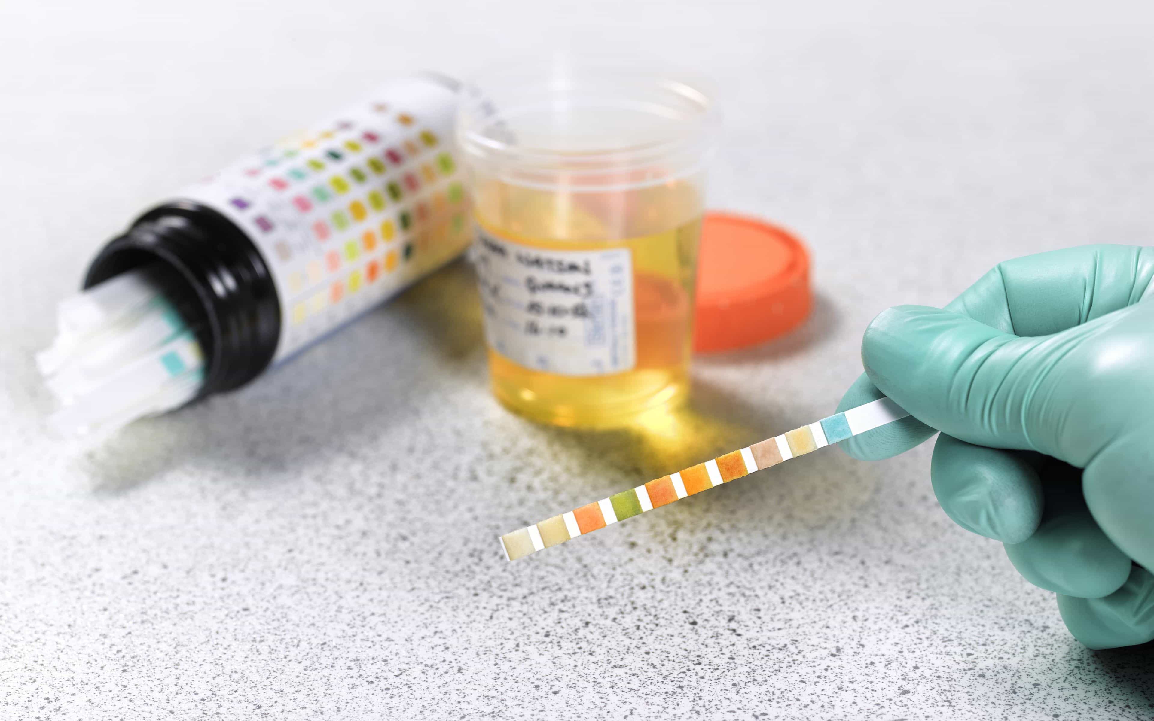 Urine Temperature Causing Failed Drug Test: Understanding The Issue And Solutions